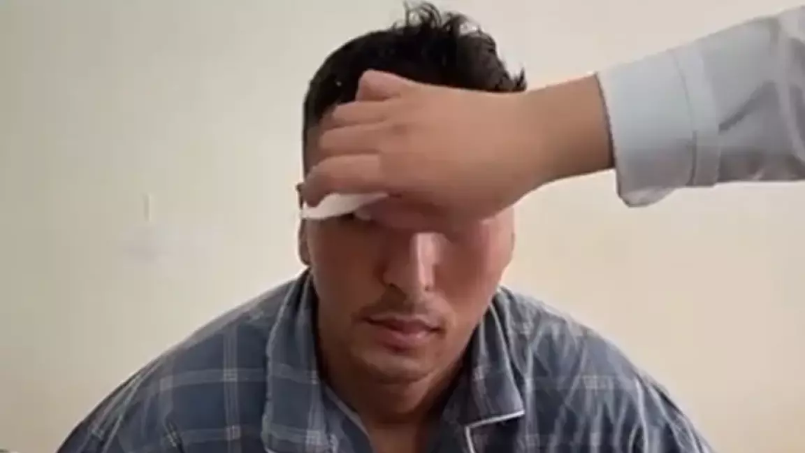 "Болашағы не болады?": Шоу көрсетемін деп жанарынан айырылған сарбаздың анасы мәлімдеме жасады