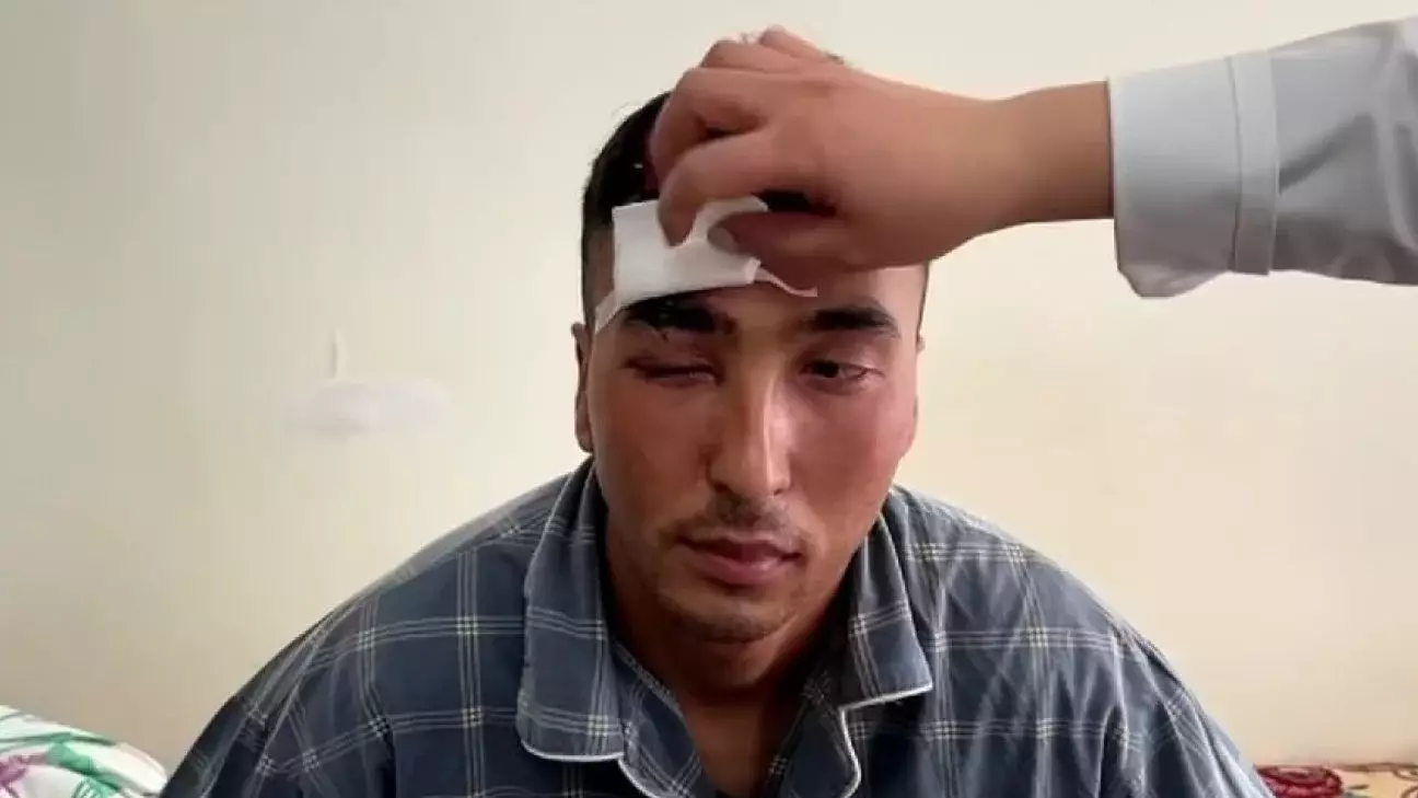 Сарбаз ант қабылдау кезінде өз басын бөтелкемен ұрып, жарақат алды