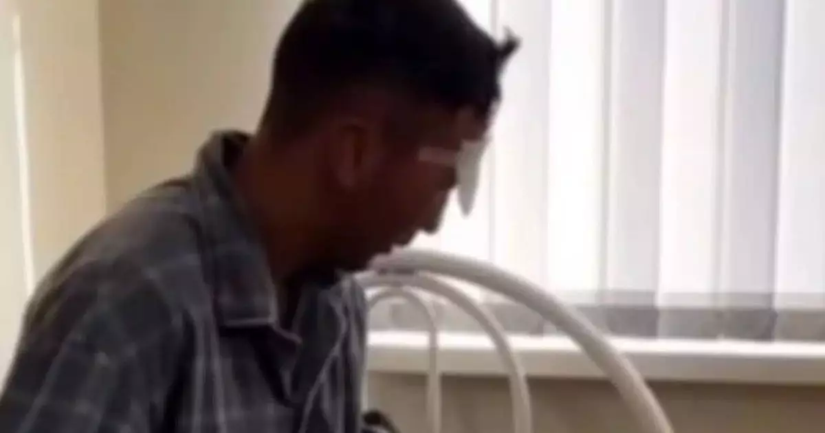  Көзінен айырылған әскери қызметкер армияда қалатын болды 