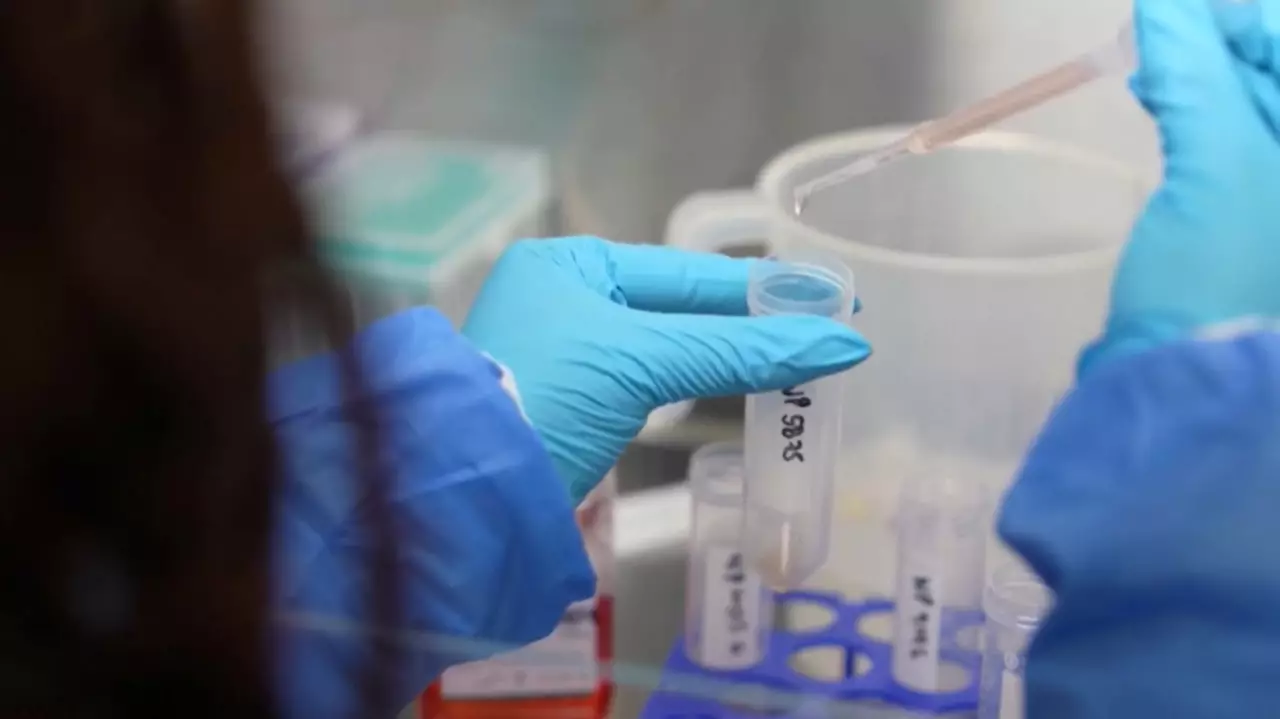 Әлемде 10 млн адам туберкулез жұқтыруы мүмкін