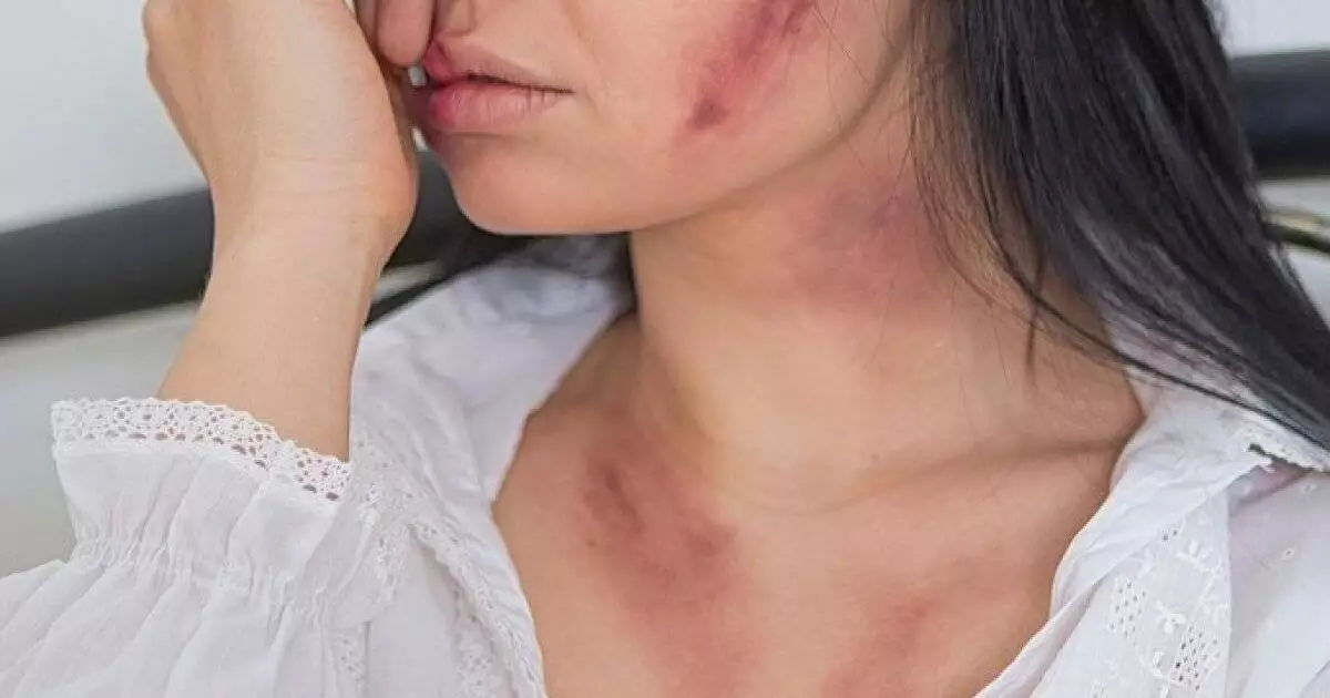  Шымкентте сүйіктісінің жағын сындырған жігіт сотталды 