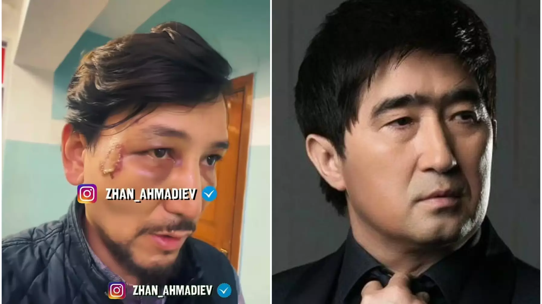  «Кешірмеймін»:  Ғалымжан Сүлеймен өзін соққыға жыққан адамдарды жауапқа тартуды талап етті (ВИДЕО)