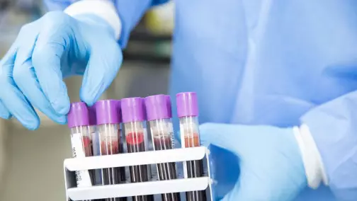 Дәрігер 50 жастан кейін әр адам білуі тиіс диагноз туралы айтты