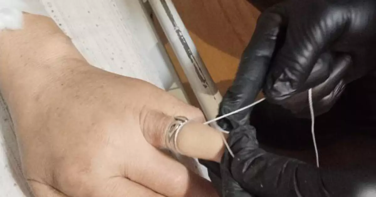   Талғарда әйел ісінген саусағындағы сақинаны шеше алмай, құтқарушыларды шақырды   