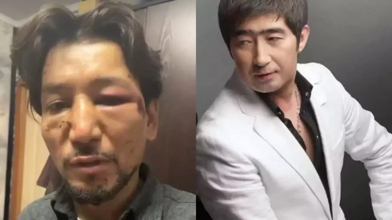 Мұқасан Шахзадаевтан таяқ жеген Ғалымжан мәлімдеме жасады