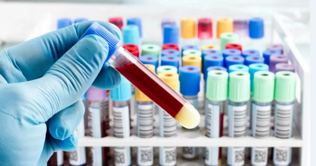   Кеселмен күрес: жетістік те, «әттеген-ай» да бар   