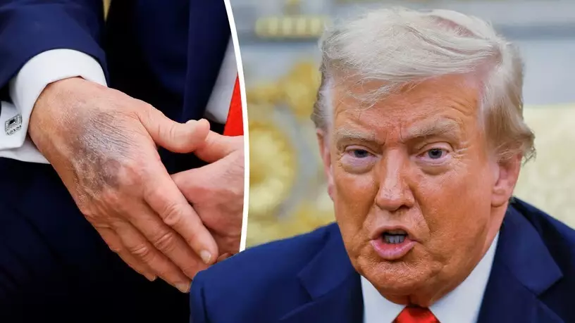 "Қабыну және тромбқа қатысты". Дональд Трамптың дәрігері шұғыл түрде мәлімдеме жасады