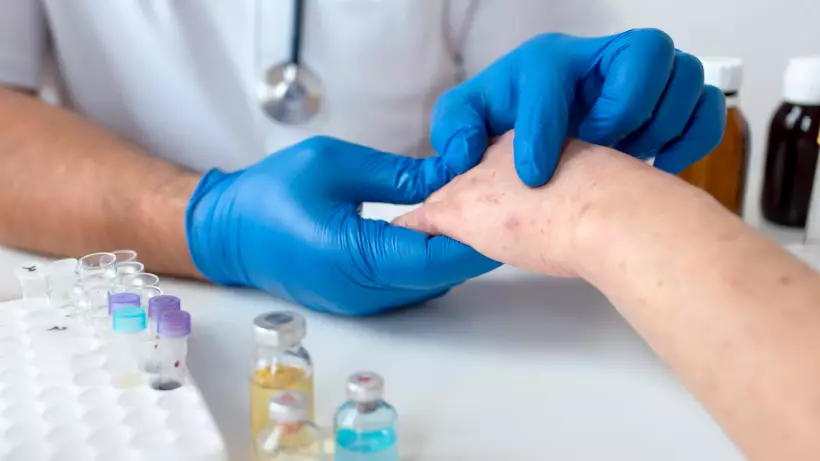 ДДСҰ әлемде қызылша ауруының қайта өршігенін ескертті