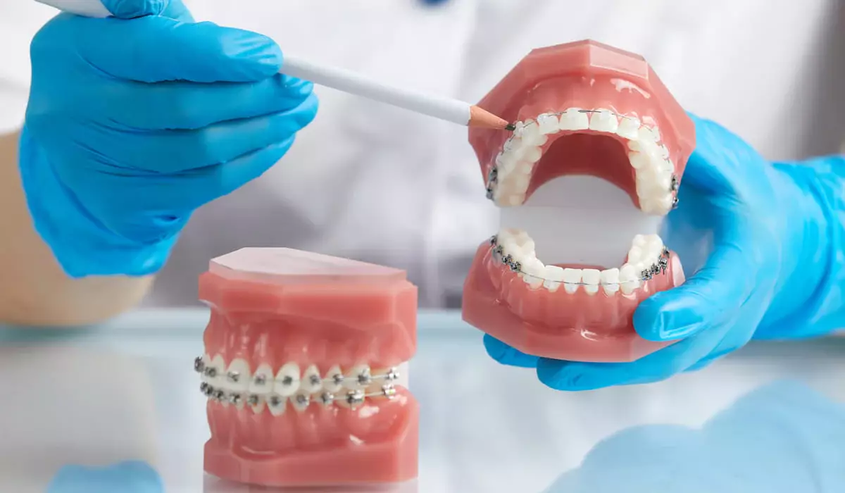 Детям будут бесплатно давать брекеты? Что говорят в Фонде соцмедстрахования