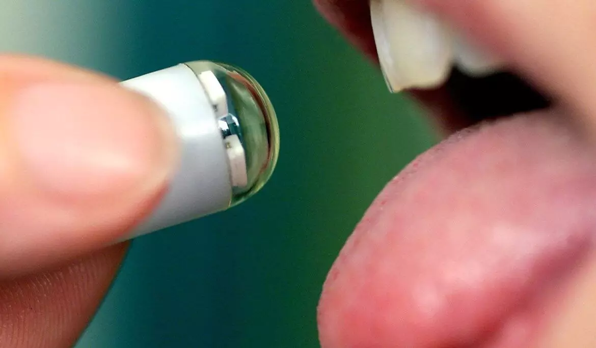 Қытай ғалымдары асқазан-ішек жолын ауыртпай зерттейтін капсулалық технологияны ойлап тапты