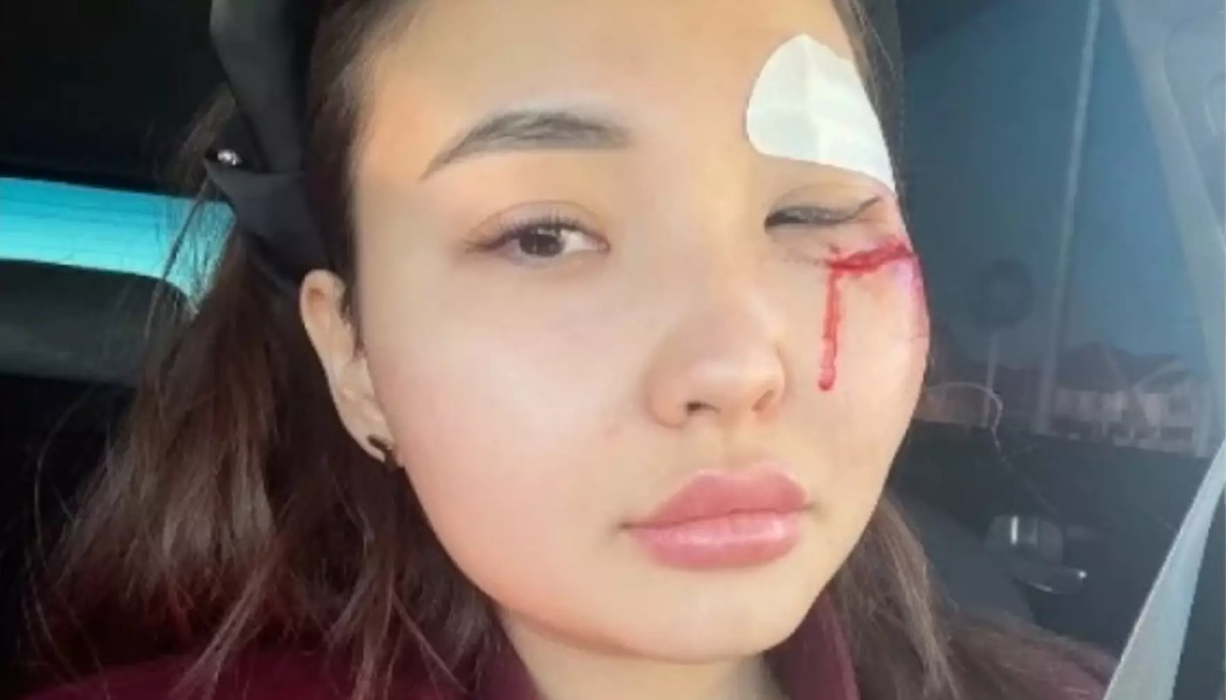 Суд по делу об избиении блогерши начинается в Атырау