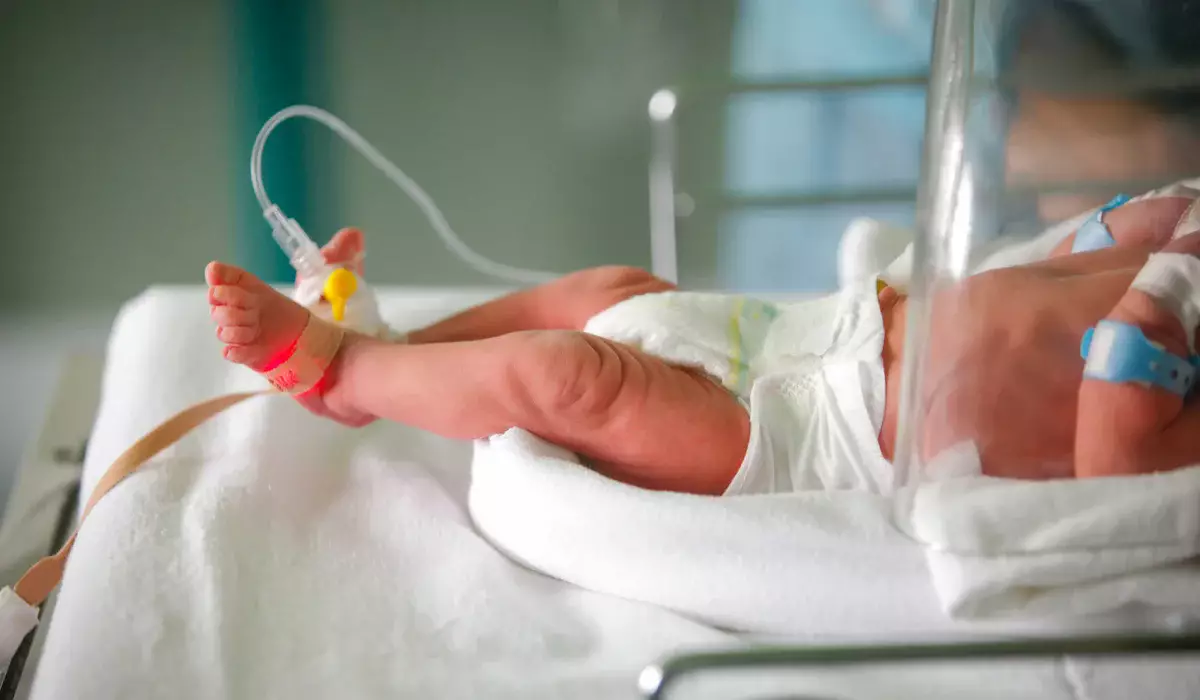 Новорожденный пережил две операции в первые часы жизни в Шымкенте