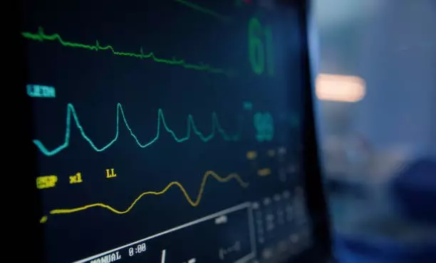 Двое из пострадавших в ДТП с поездом в Карагандинской области в реанимации