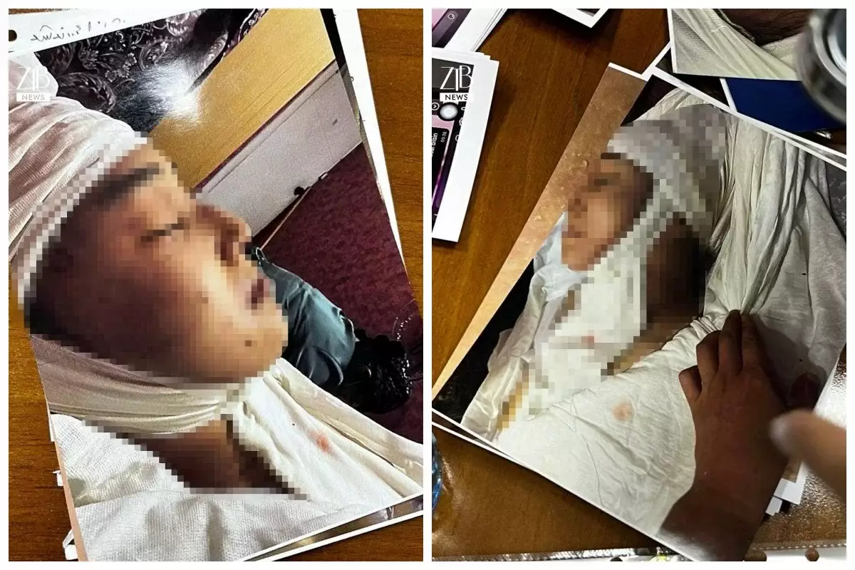 «Өлімші етіп сабаған»: Ақнәр Гүлстанның өліміне қатысты жантүршігерлік дерек шықты