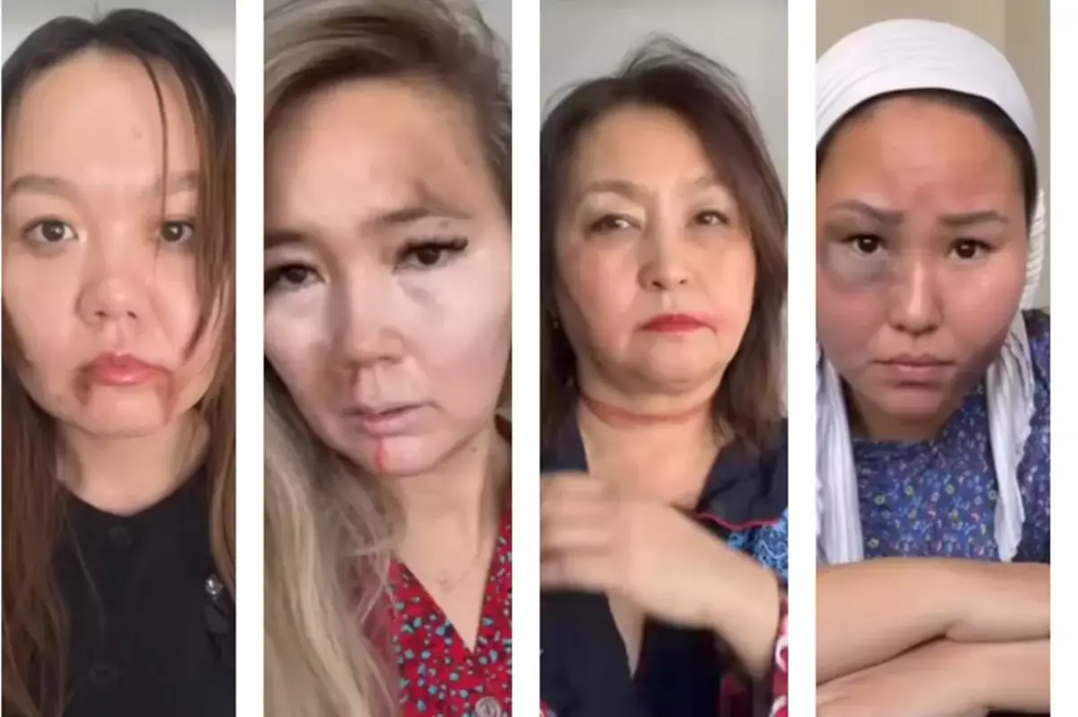 Синяки как манифест: учителя в Актау выступили против насилия - новости на Lada.kz 15.12.2025