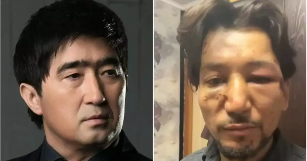  Соққыға жығылып, елге үндеу жасаған `Нұр-Мұқасан` тобының мүшесі жаңа әнін шығарды (ВИДЕО) 