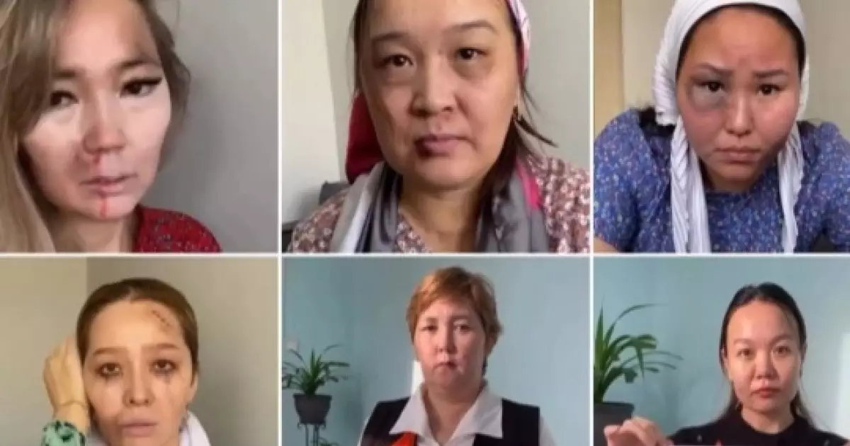  `Бет-аузы көгерген`: Маңғыстаулық мұғалімдер зорлық-зомбылыққа қарсы шыққан видеосы тарады 