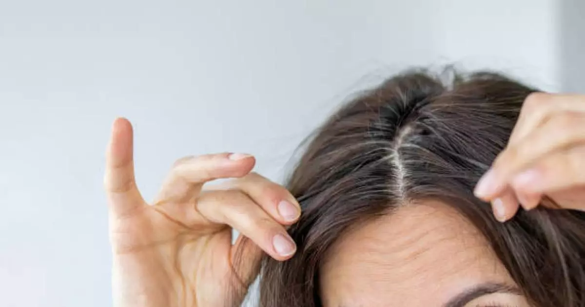  Дәрумен жетіспеушілігі қартаю белгілері секілді көрінуі мүмкін – дәрігер 