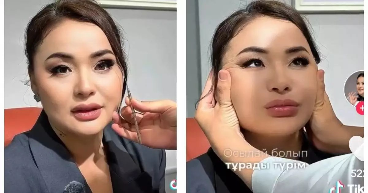  «Тұрсынбектен ұят болады»: Пластикалық ота жасататынын айтқан Мөлдір Мұқанова сынға қалды (ВИДЕО) 