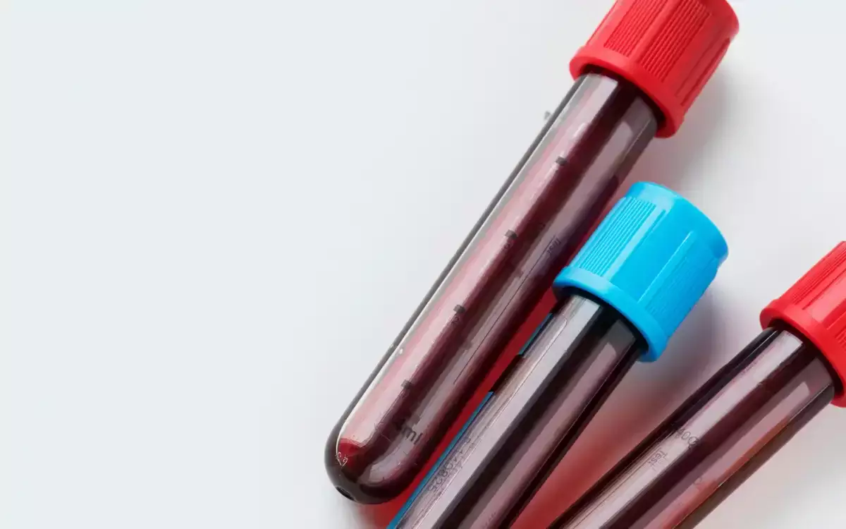 Центр по профилактике ВИЧ Астаны опроверг данные о “массовом росте ВИЧ среди молодежи”