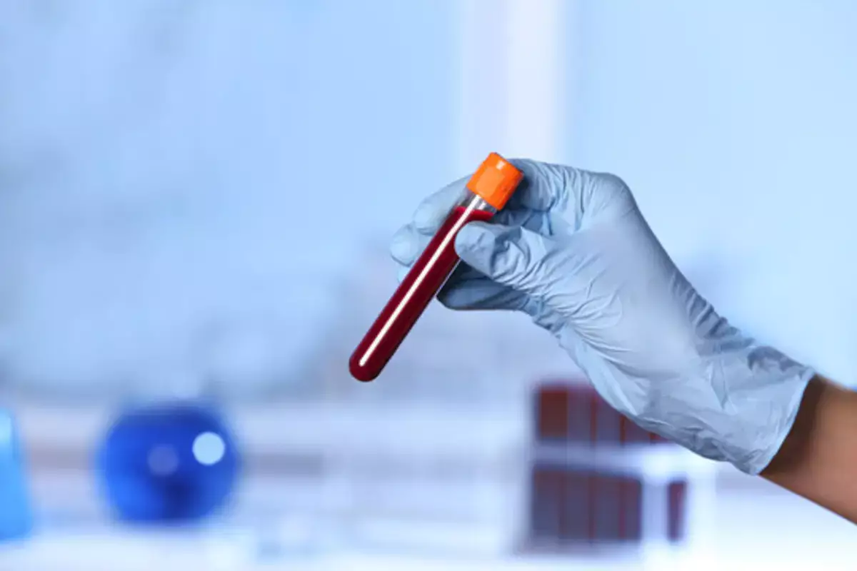 Кровь с тайной: что скрывает отрицательный резус-фактор - новости на Lada.kz 19.12.2025