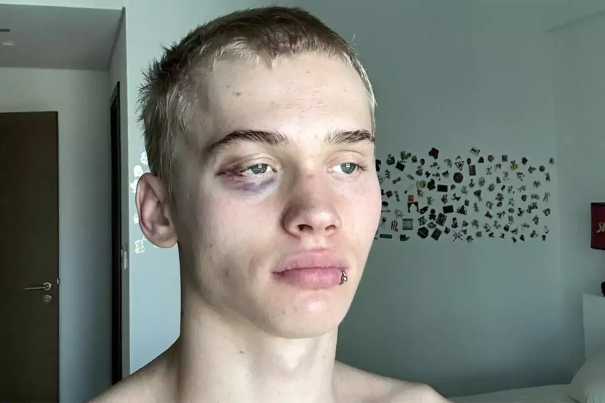 Блогер Милохин мечтает о боях с чемпионами — профи смеются - новости на Lada.kz 19.12.2025