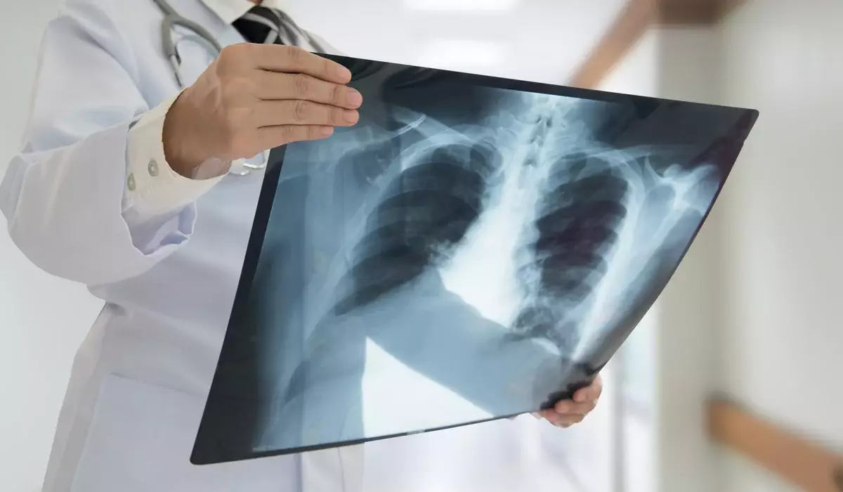 «Проткнуто как шарик»: женщине пробили легкое после иглоукалывания в ВКО