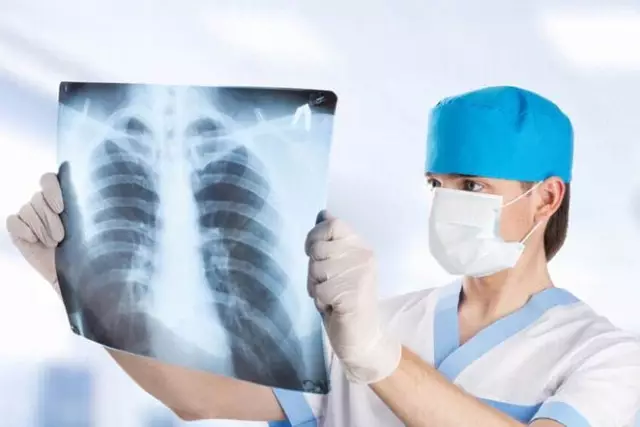 ШҚО-да әйелдің өкпесін инемен тесіп алған дәрігерлер жазалана ма?