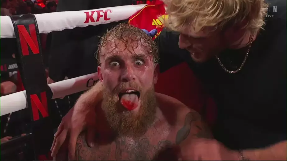 Стало известно о последствиях нокаута в бою Джошуа - Пол