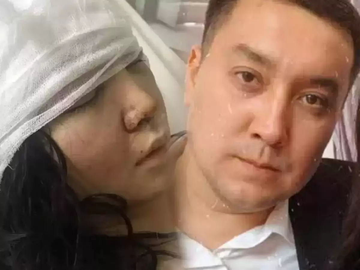 "Анашым, мен өліп барам": күйеуінің соққысынан тірі қалған Алтынайдың оқиғасы