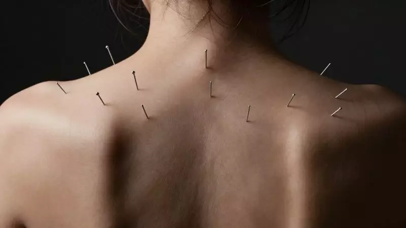 Иглоукалывание едва не привело к трагедии в Казахстане