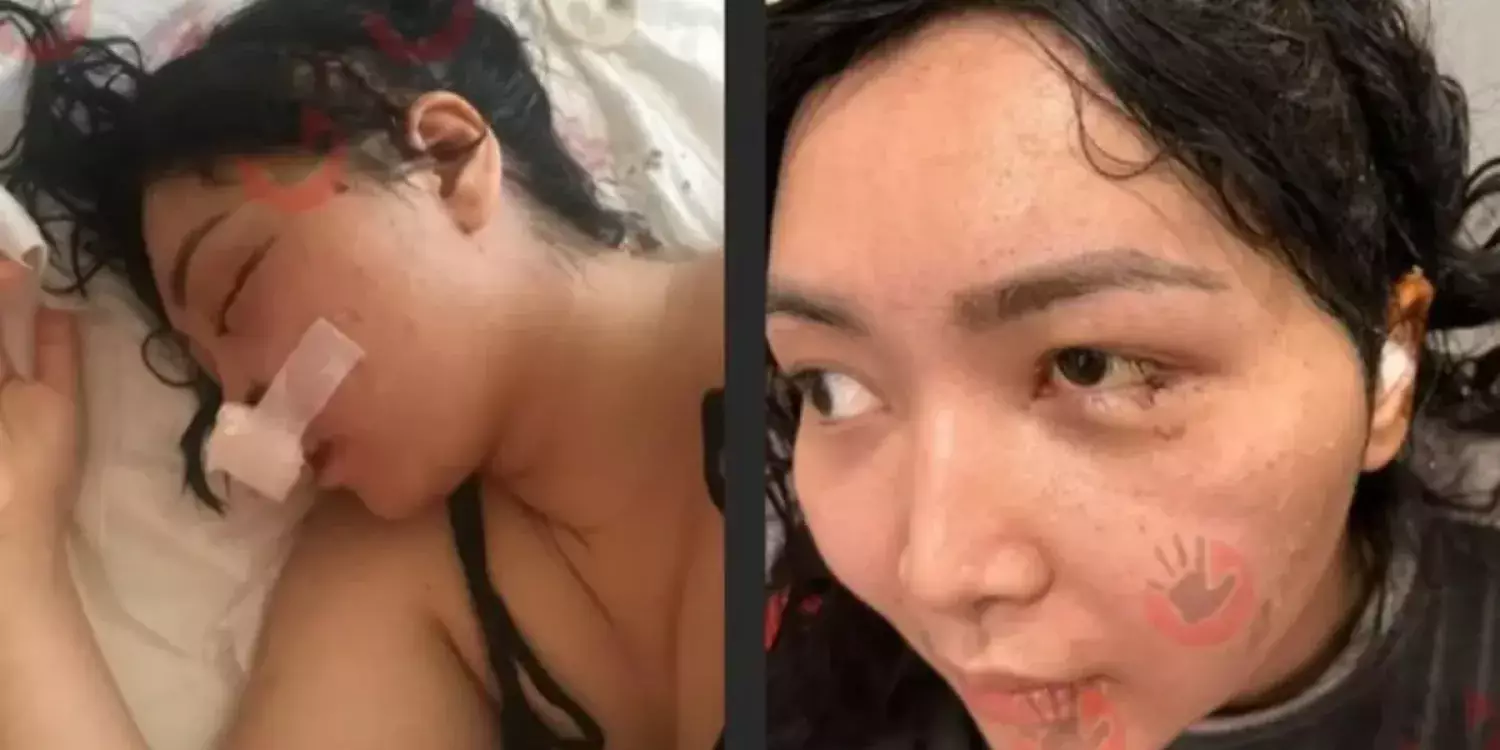 Әйелінің бас сүйегін сындырған ер адам жазасыз қалды