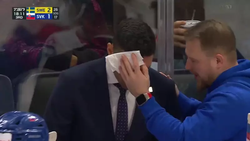 Хоккейден әлем чемпионатында бапкердің басына шайба тиді