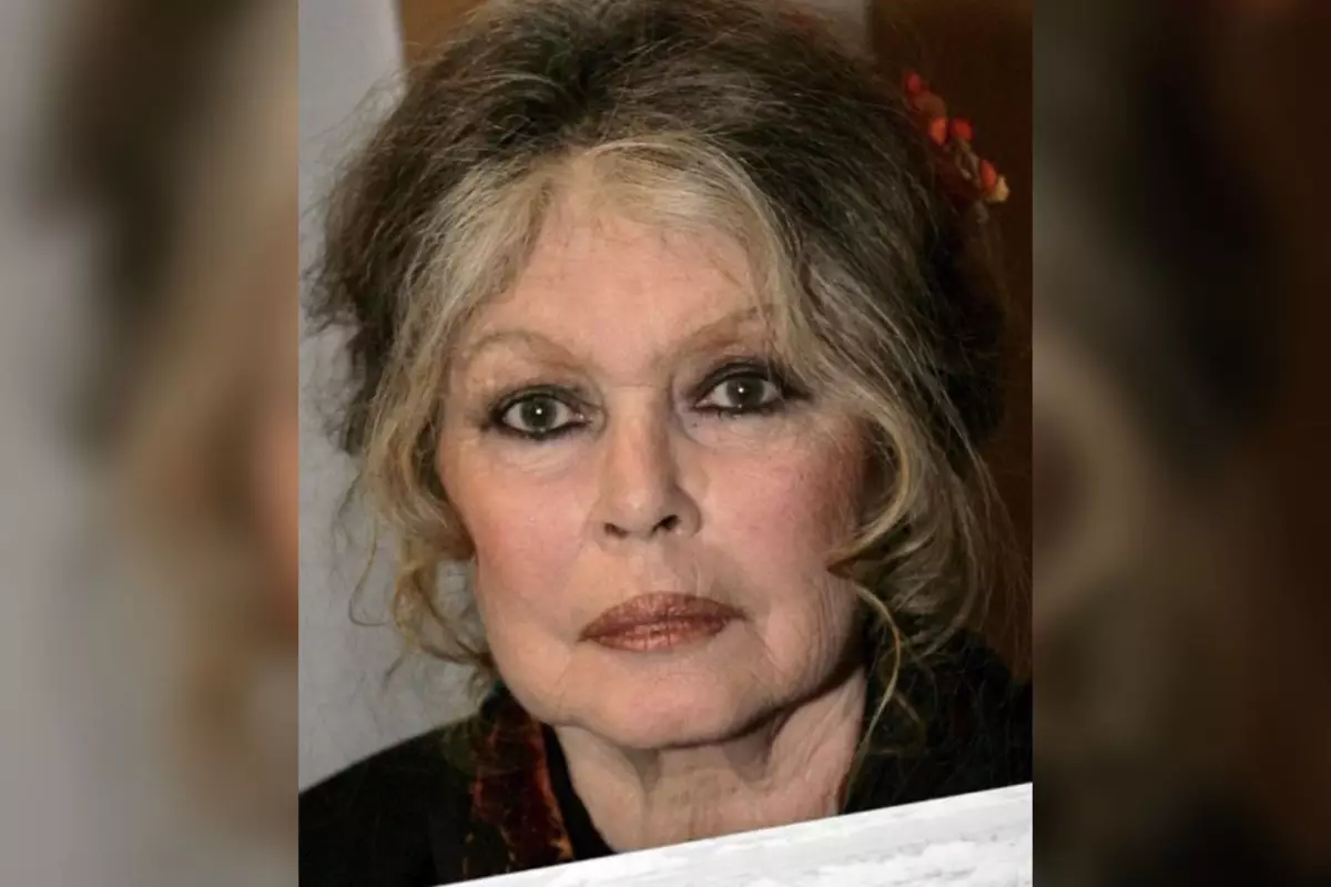 Әйгілі француз актрисасы Брижит Бардо өмірден озды