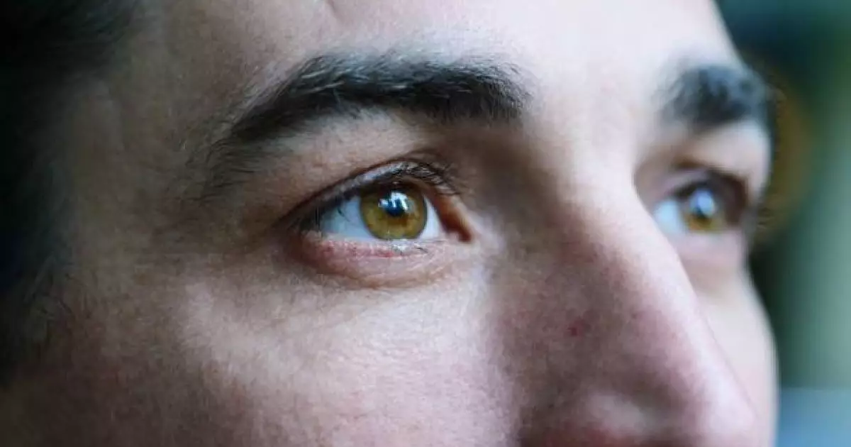  Холестериніңіз жоғары екенін көзге қарап анықтауға болады – дәрігер 