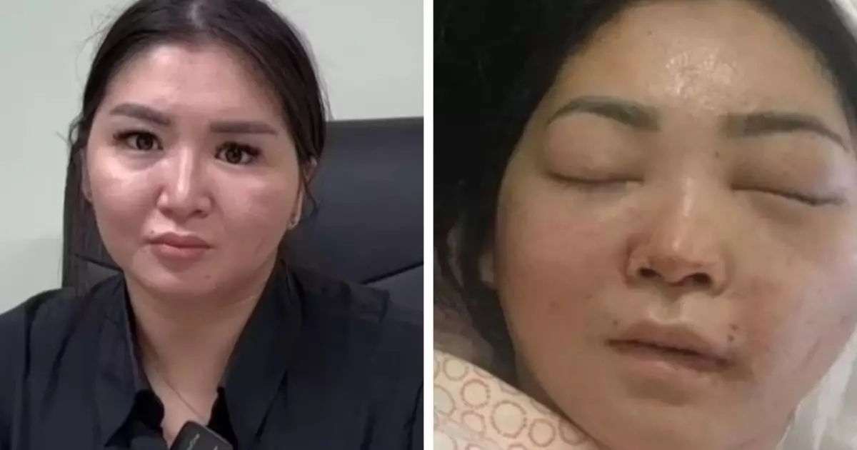  Күйеуі сабап, мүгедек болып қалған әйел сотталушының қоныс-колонияға ауыстырылғанына қарсы 