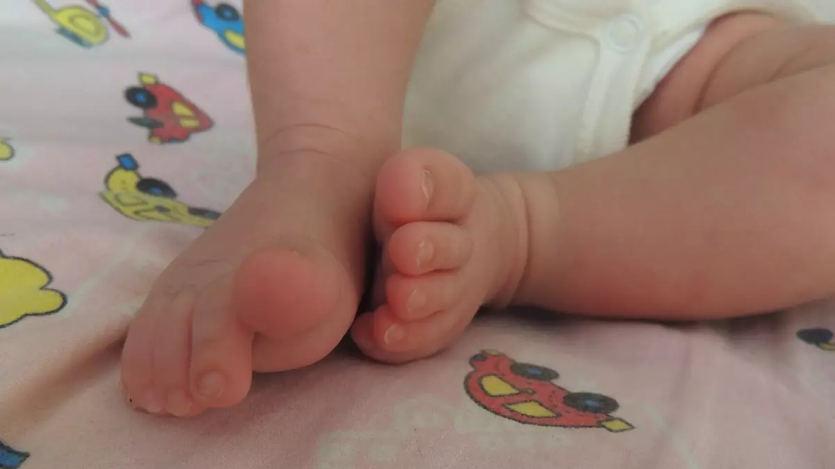 Атырауда дәрігерлер тынысы тоқтап қалған 4 айлық сәбиді құтқарды