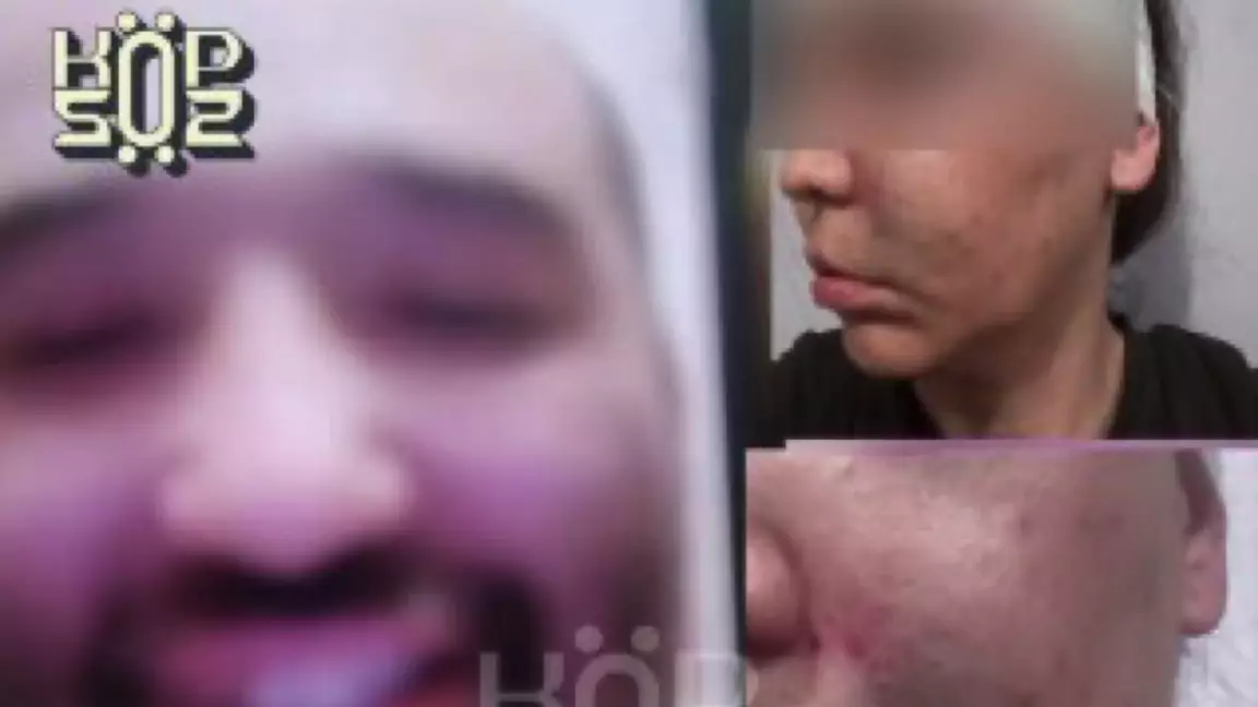 Бұрынғы күйеуі аңдып, қоқан-лоққы көрсетіп жүр: астаналық әйел дабыл қақты