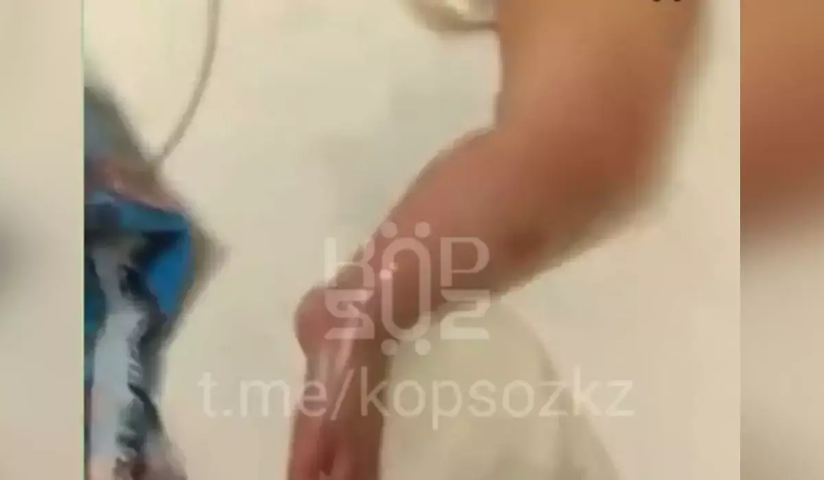 Астана ауруханасындағы дау: сәби емдеу кезінде күйіп қалған (ВИДЕО)