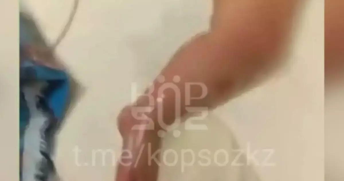  Астана ауруханасында дәрігер салғырттығынан сәби күйіп қалды 