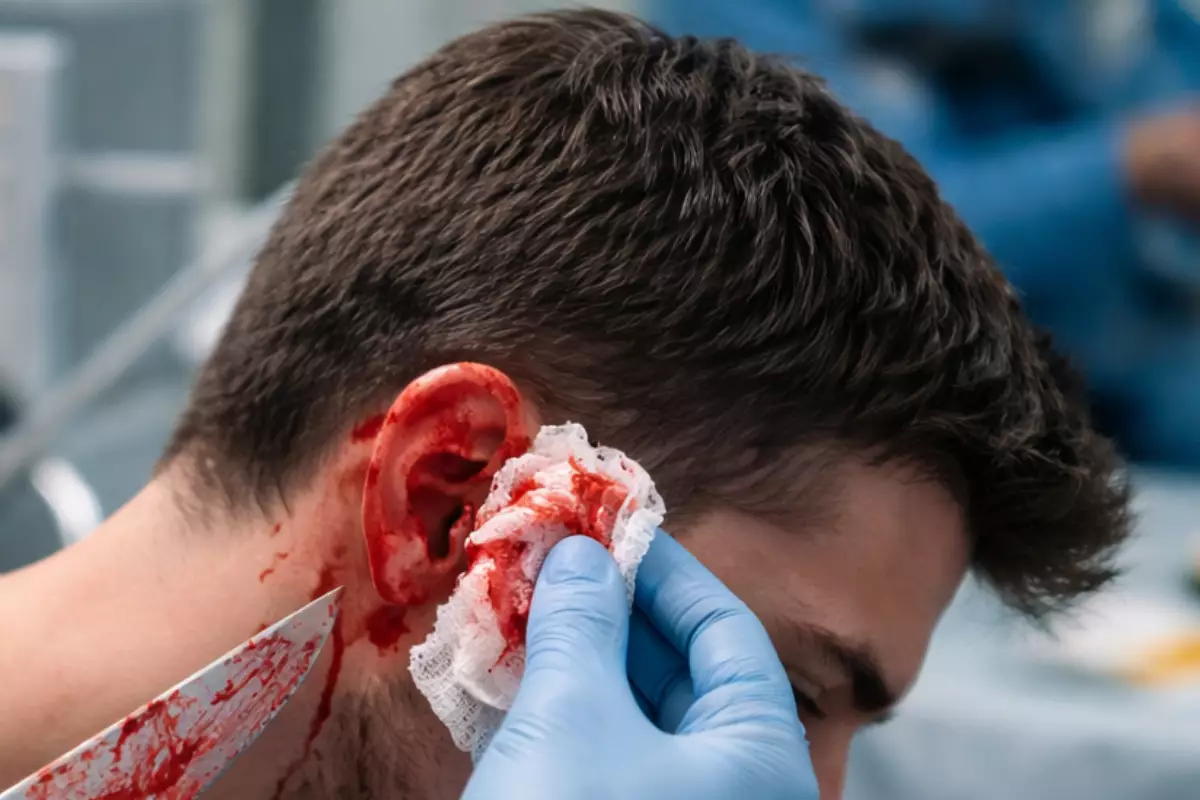 В Миялы конфликт молодых людей закончился ножевым ранением уха