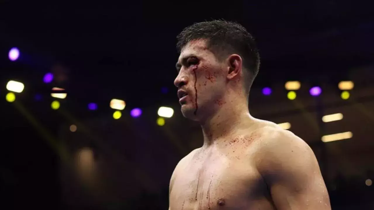 Определился следующий соперник Бивола