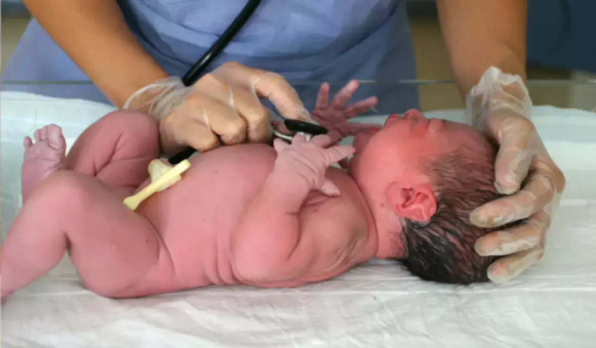 В Польше младенец родился в состоянии сильного опьянения - новости на Lada.kz 11.01.2026