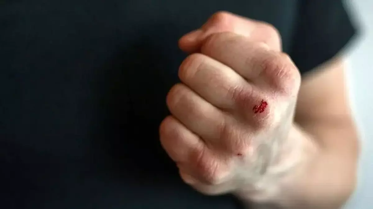 Иностранный студент стал жертвой агресии в Шымкенте: чем закончился конфликт