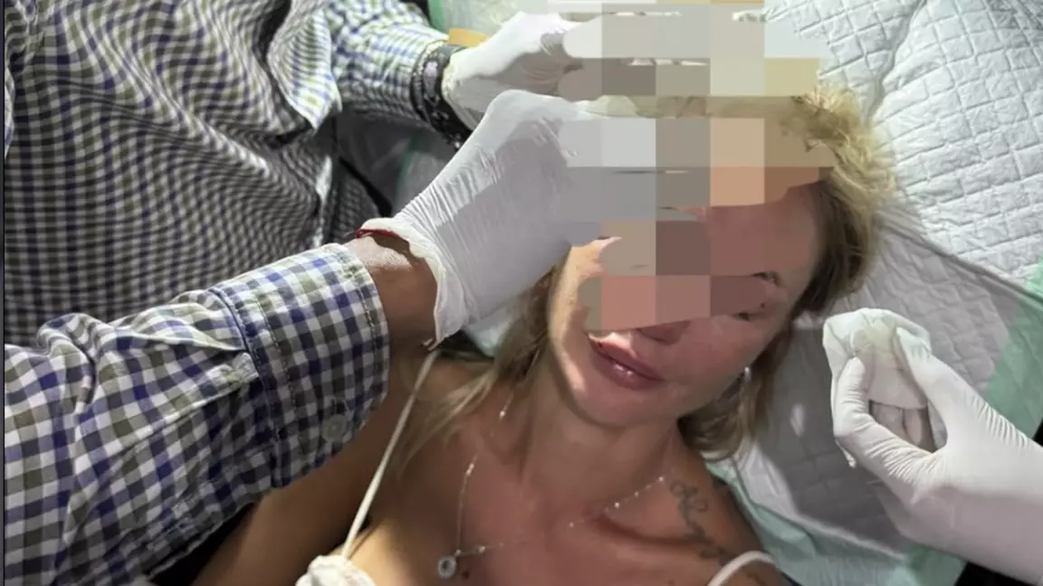 Балидегі төбелес: ресейлік блогер қазақстандық модель шабуыл жасады деп мәлімдеді