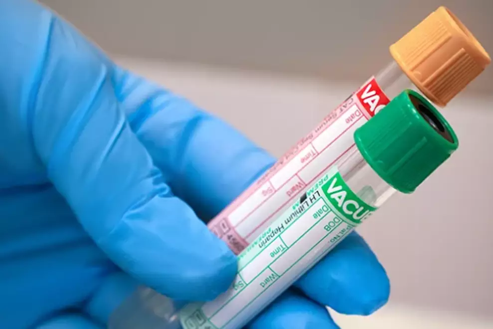 INVIVO обвинили в злоупотреблении доминирующим положением на рынке лабораторных услуг