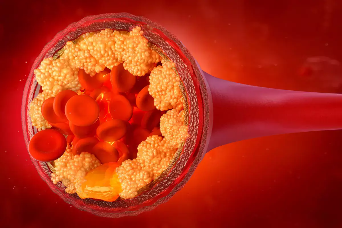 Назван способ снизить уровень холестерина без лекарств - новости на Lada.kz 13.01.2026