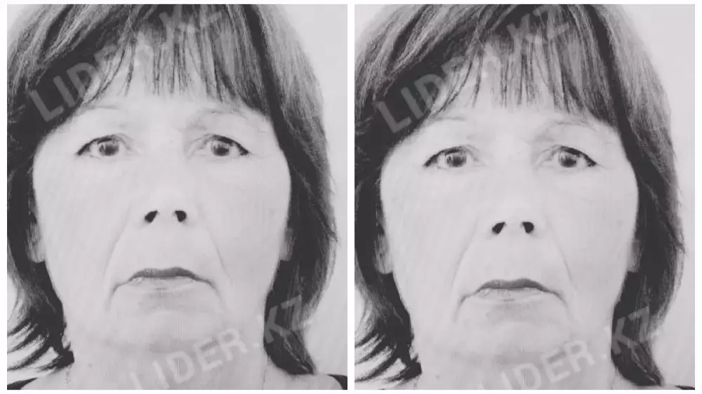 Пенсионерка насмерть замёрзла на территории больницы в Петропавловске