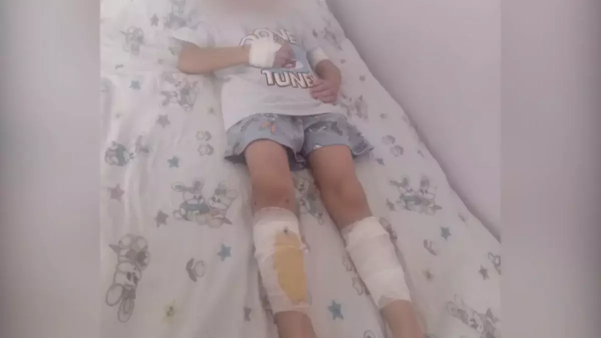 Денесін үтікпен күйдірген: анасынан зәбір көрген балалар ауруханада жатыр