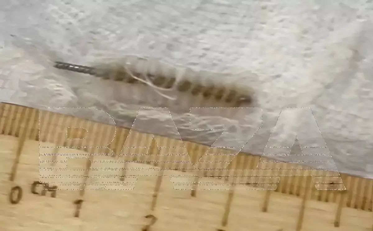 Забыли "ершик" в матке: гинеколог едва не погубила пациентку в России